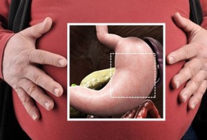 getty_rm_photo_of_bariatric_surgery_target_area-_